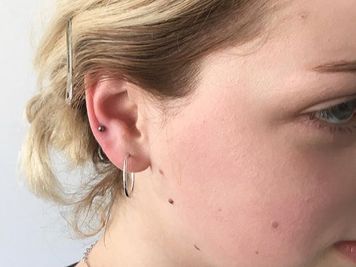 auricle piercing pain level