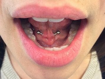 cleaning tongue web piercing
