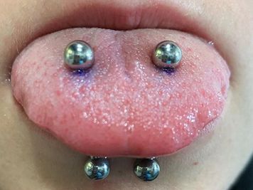 double tongue piercing experience