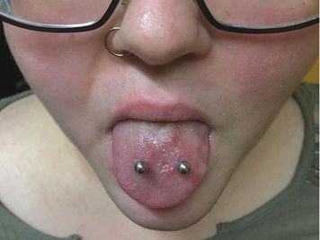 double tongue piercing healing