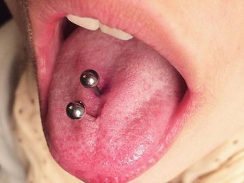 double tongue piercing swelling