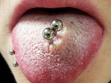 double tongue piercing types