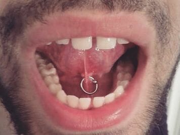 frenulum tongue image