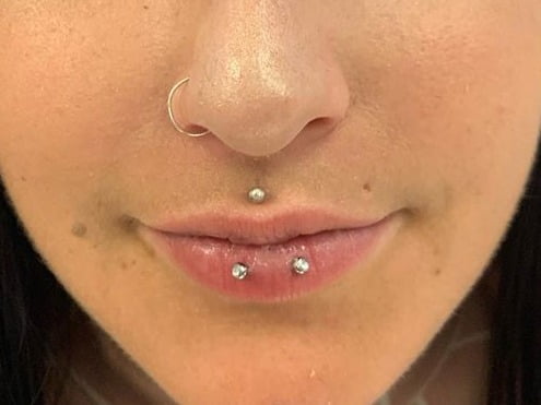 horizontal lip piercing scars