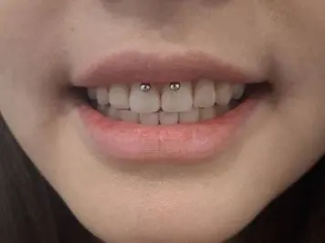 how much does a smiley piercing cost