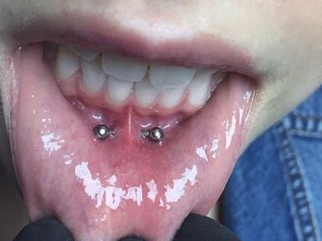 how to clean frowny piercing