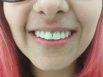 how to hide a smiley piercing