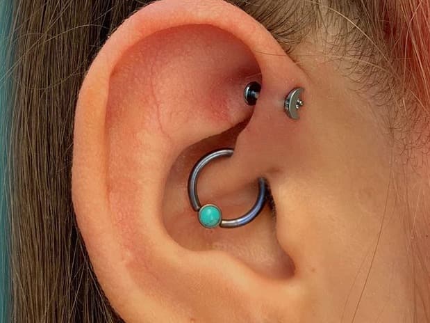 infected forward helix piercing