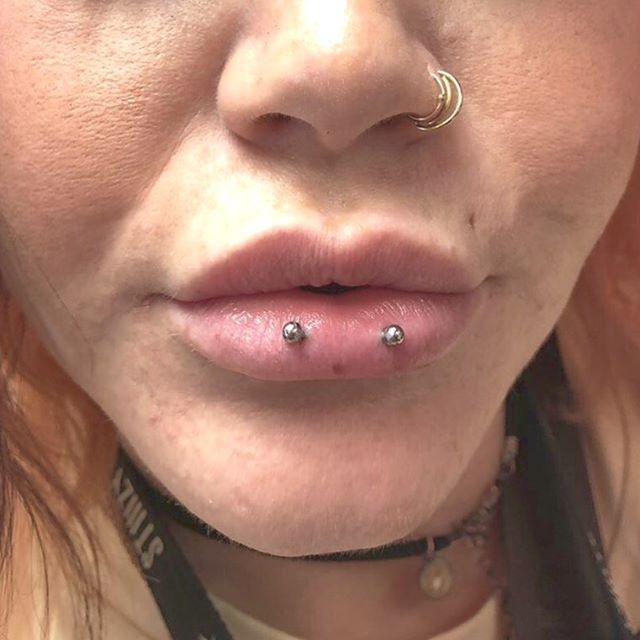 infected horizontal lip piercing
