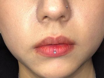 inverse vertical labret cost