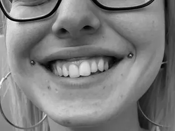 joker smile piercing