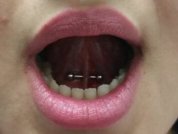 men web piercing tongue