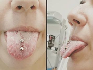 multiple tongue piercings