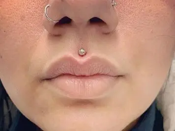 philtrum lip piercing