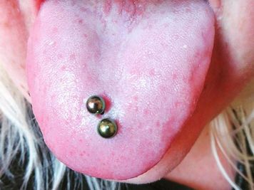 risks of double tongue piercing