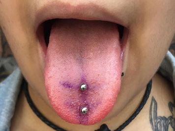 risks of tongue piercing