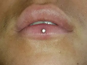 scar ashley piercing