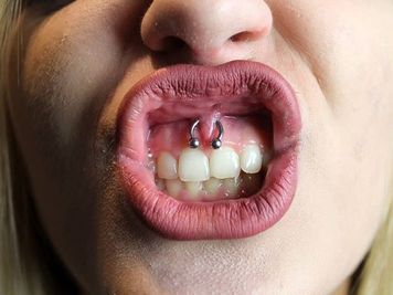 lip frenulum smiley piercing