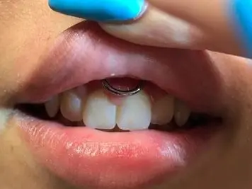 lip frenulum piercing at home