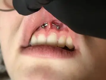 smiley piercing size