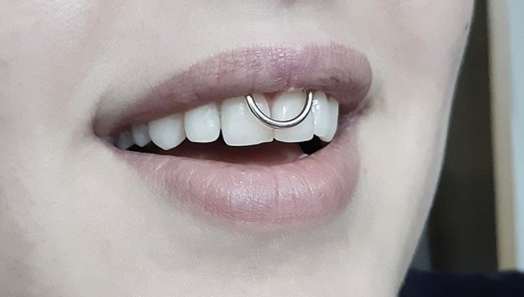 Smiley Piercing 50 Image Ideas jewelry, pros & cons, design & care ...