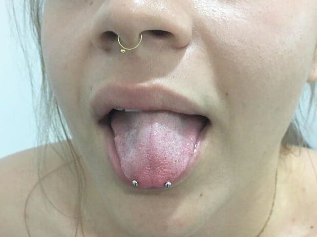 horizontal tongue