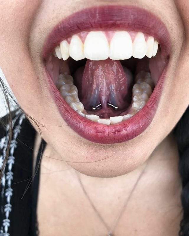 tongue frenulum piercing pain