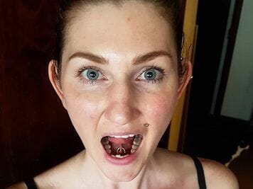 tongue frenulum piercing procedure