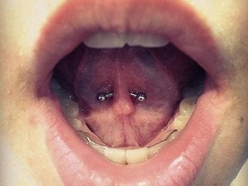 tongue frenulum piercing rejectoon