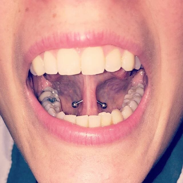 tongue frenulum piercing