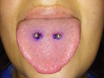tongue venom piercing