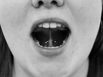 tongue web piercing procedure