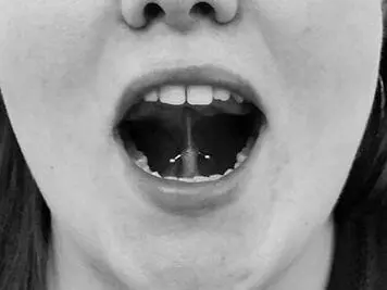 tongue web piercing procedure