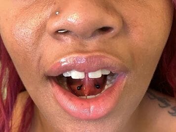 tongue web piercing rejection