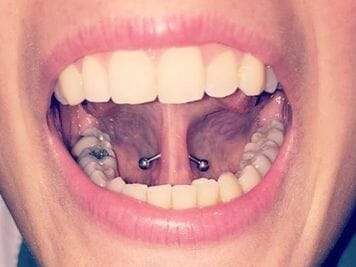 tongue web piercing swelling