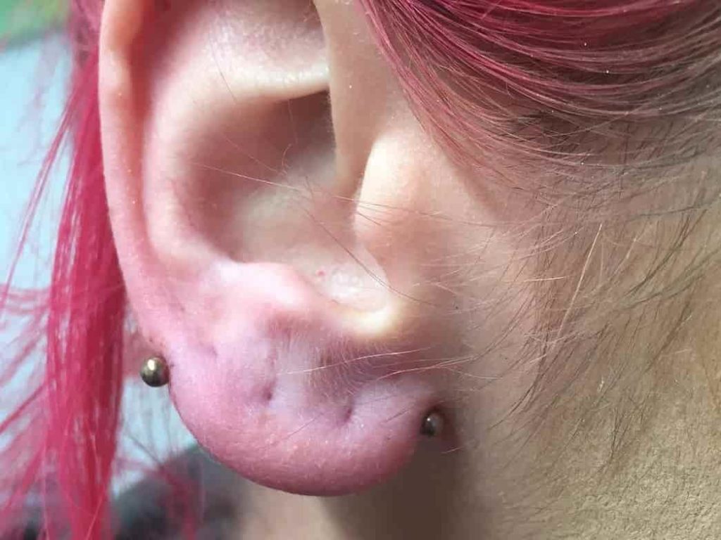 ear piercing example