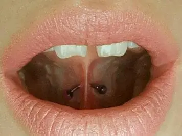 under tongue piercing jewelry