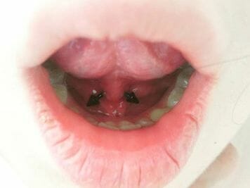 under tongue piercing price