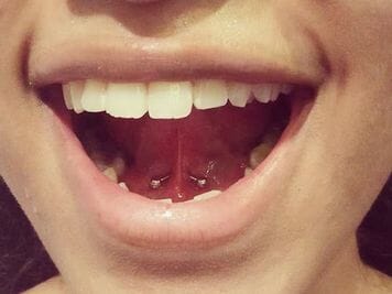 web of tongue piercing